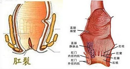 日本语肛门ポリープ是什么意思？震惊！这种罕见病症竟然影响了大量日本民众的健康！