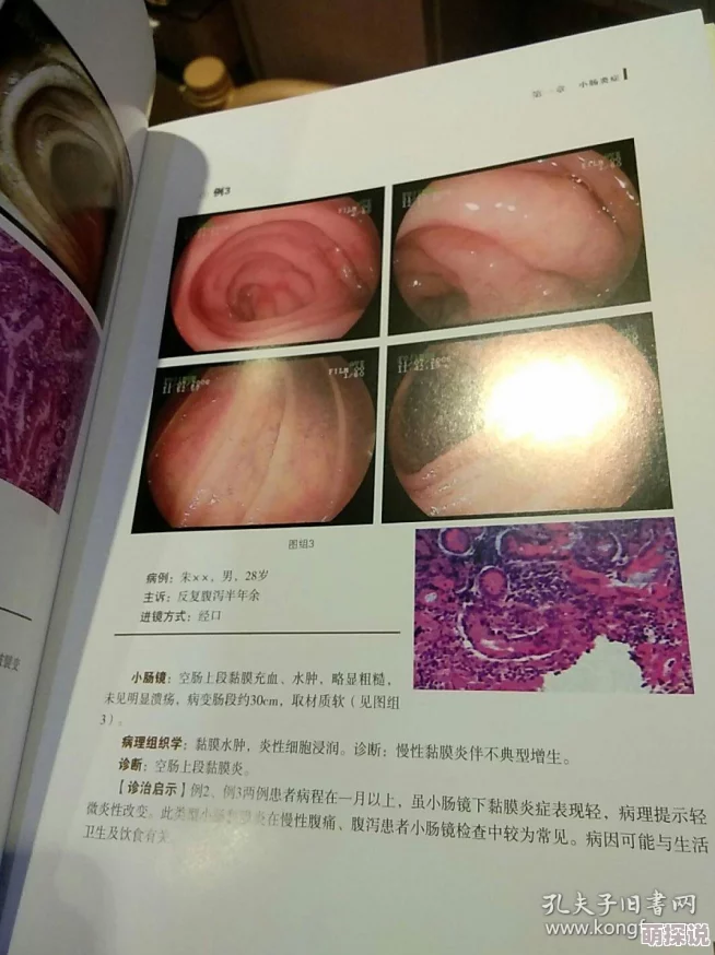 腹部拼音fùbùpīnyīnAI辅助诊断消化系统疾病技术2025年将迎来新突破